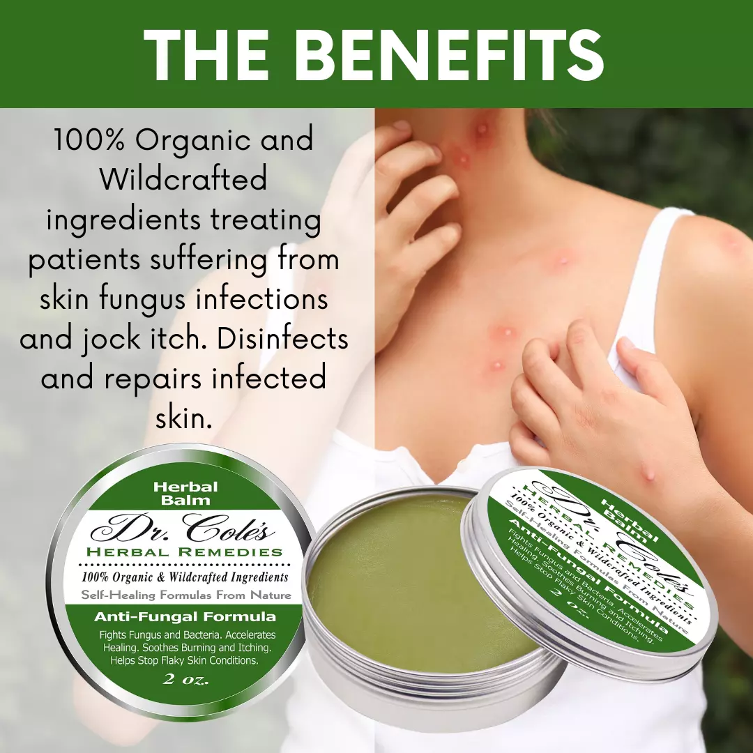 07 - Dr. Cole's Antifungal Balm - Image 9