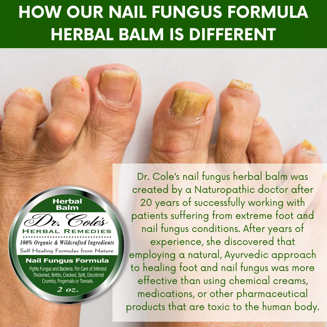 12 - Dr. Cole's Nail Fungus Balm - Image 10