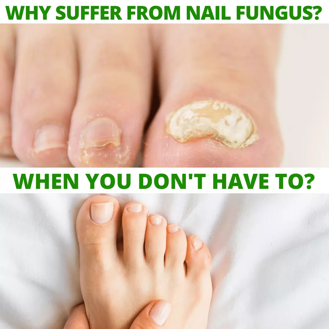 12 - Dr. Cole's Nail Fungus Balm - Image 9