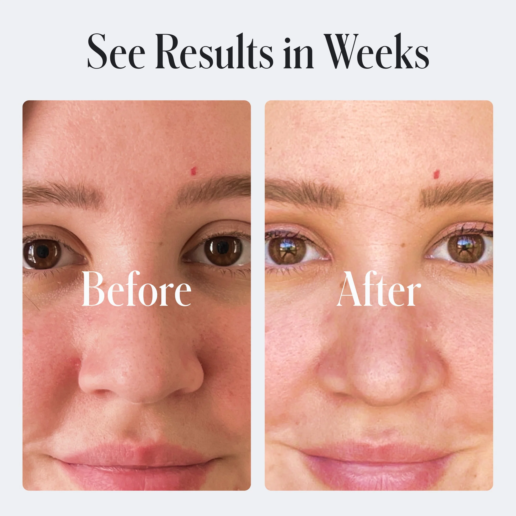 Acne Control Face Wash - Image 11