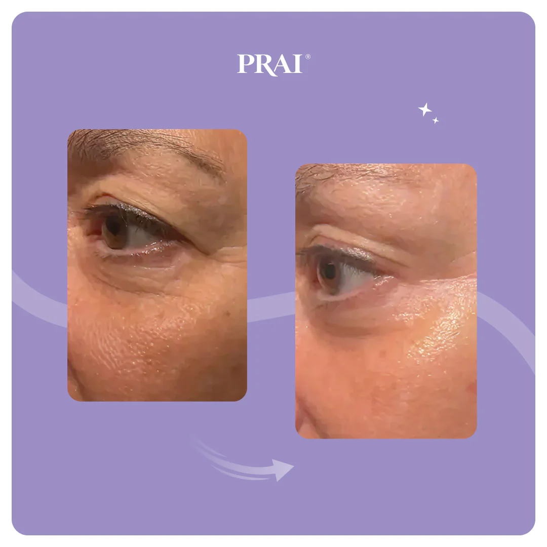 Ageless Eye Tight Uplift Serum - Image 4