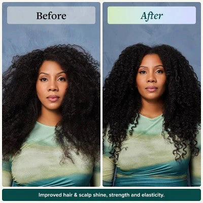 Alodia Nourish and Grow Healthy Hair and Scalp Oil 8.5 fl oz - New - Image 5