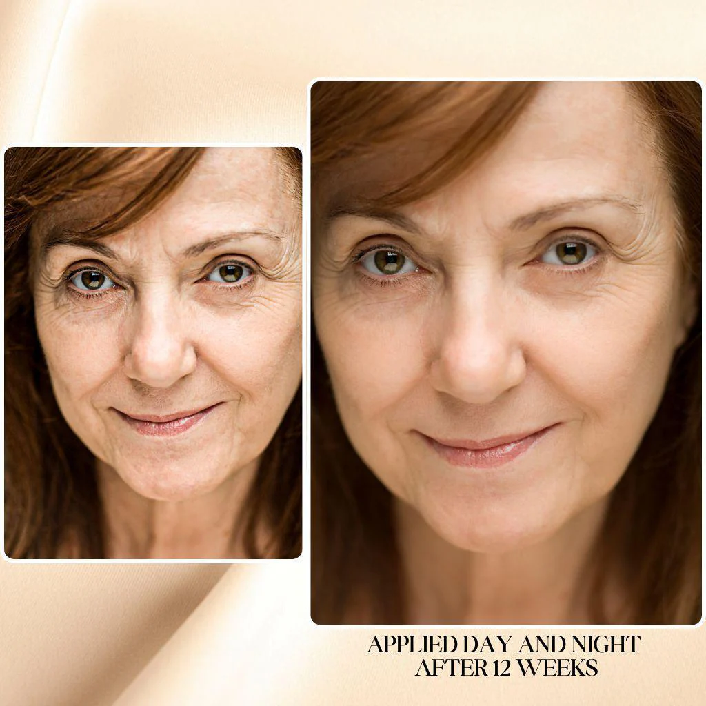 Anti-Aging Bundle, Large - Image 9