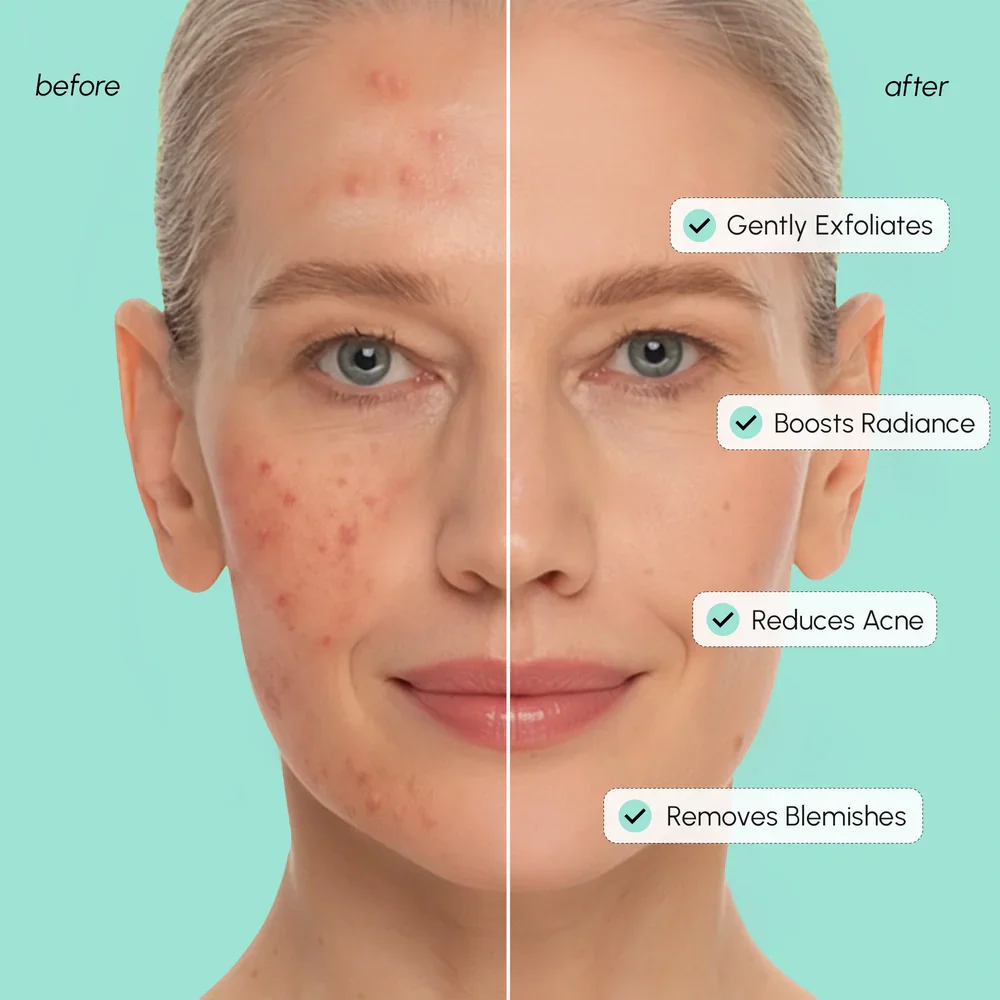 Azelaic Acid Soothing Pads - Image 4