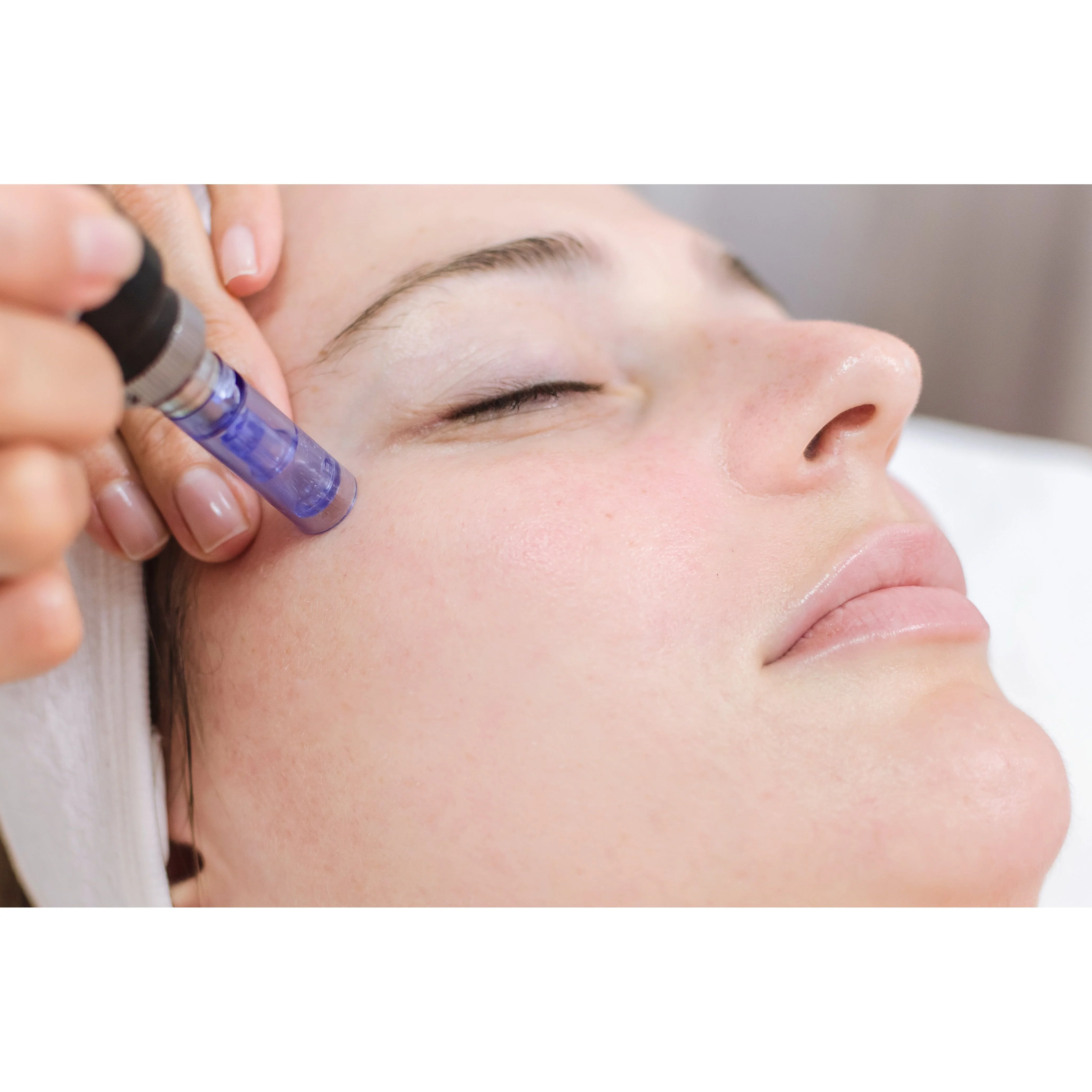 Bio Pen Needle Tips - Image 2