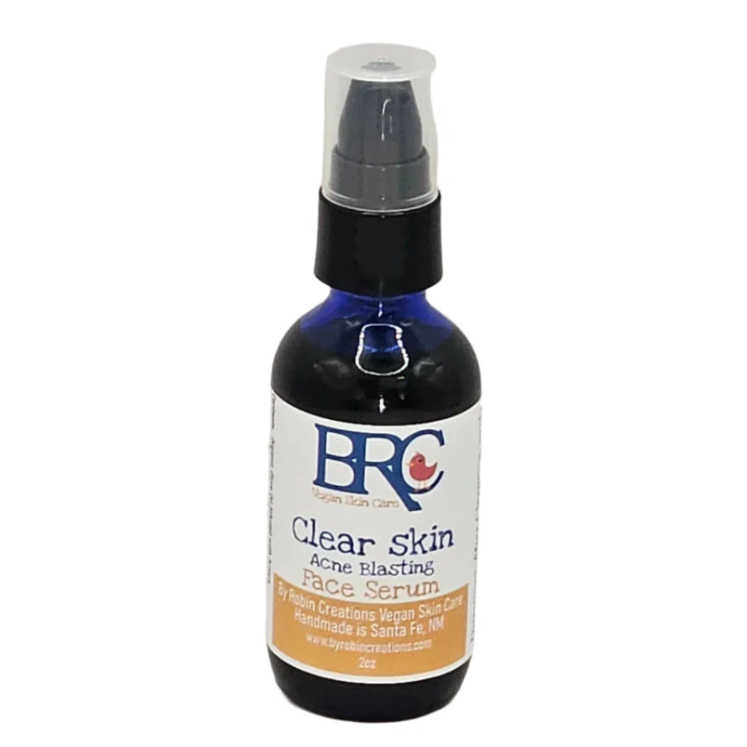 Clear Skin Deluxe Acne Healing Facial Bundle w/ Free Healing Cleansing Bar - Image 3