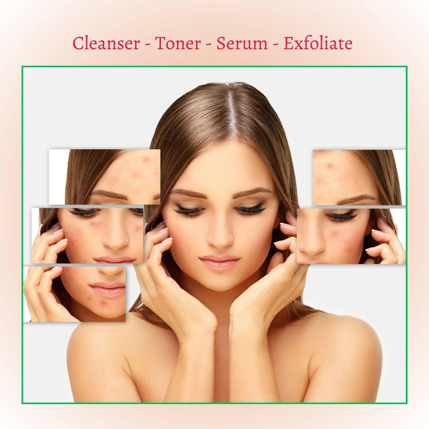 Deep Treatment Acne Cleansing Foam Cleanser - Image 4