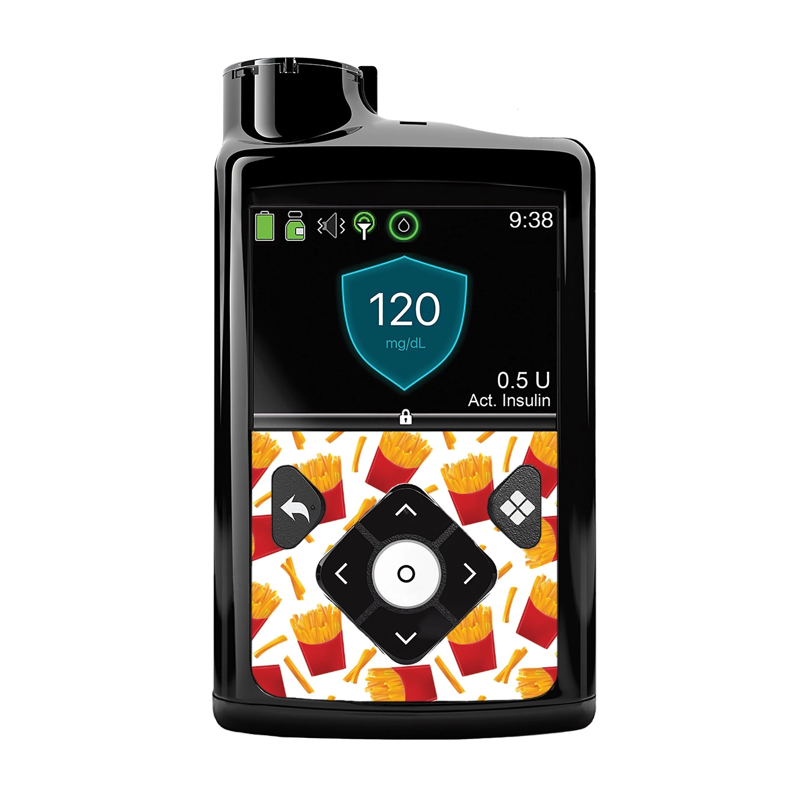 French Fries for Medtronic MiniMed 770G & 780G