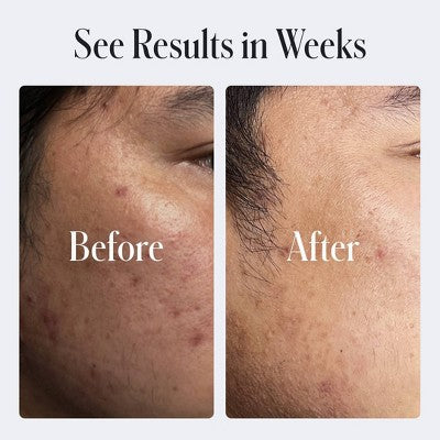 Geologie Clear System Clear Skin Face Cream 2 fl oz - Imperfect Box - Image 5