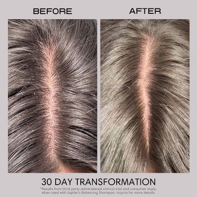 Jupiter Anti-Dandruff Restoring Scalp Serum 2.1 fl oz - Imperfect Container - Image 10