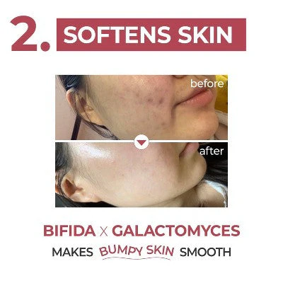 numbuzin No.3 Skin Softening Serum 1.69 fl oz - Imperfect Box - Image 7