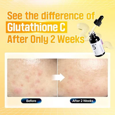 numbuzin No.5+ Glutathione Vitamin Concentrated Face Serum Travel Size 1.01 fl oz - Imperfect Box - Image 5
