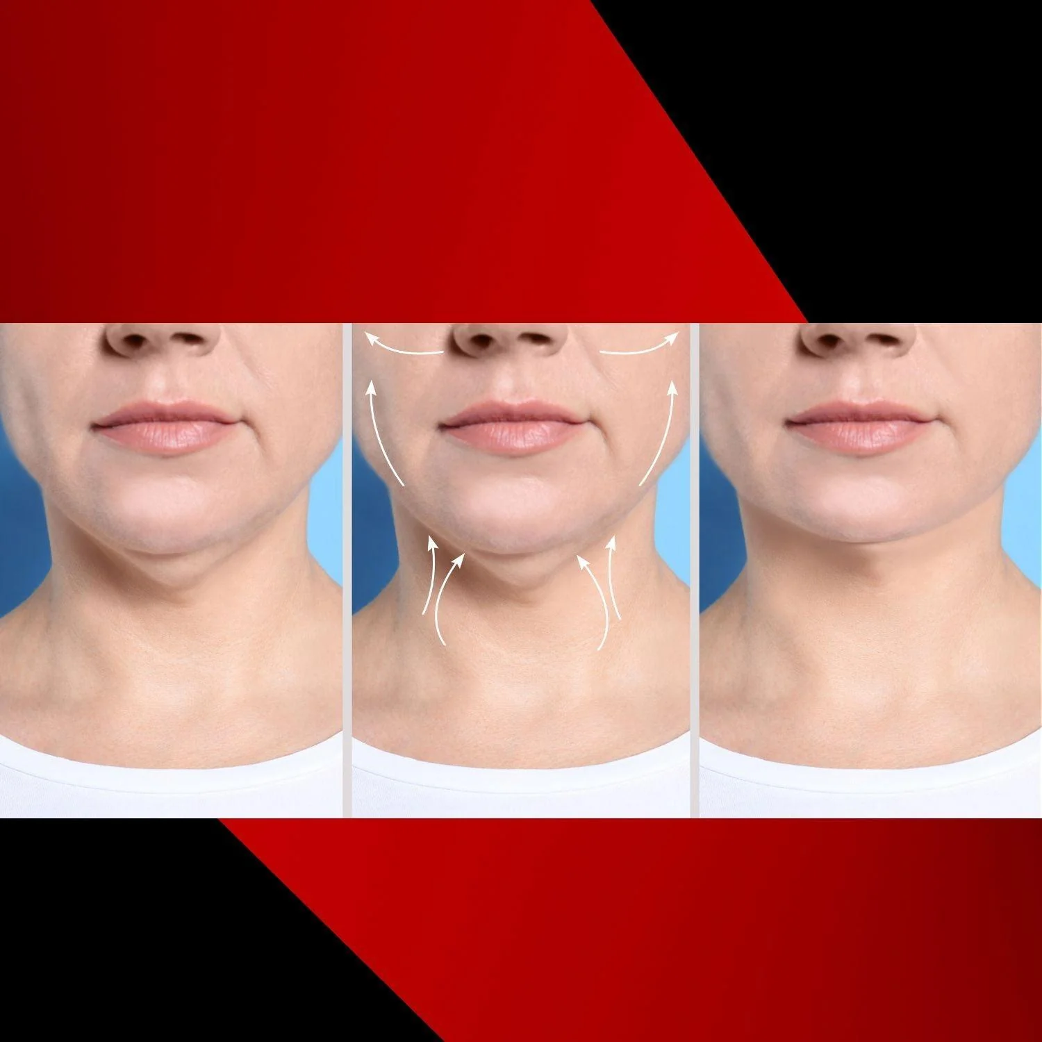 Resilient Youth Neck + Décolleté Cream - Image 5