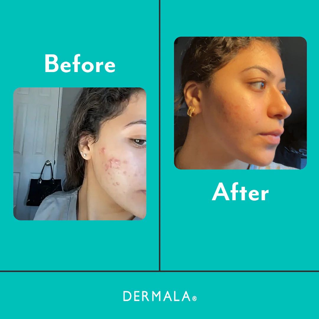 SUPPLEMEANT to Be® - DIM Skin Mix - Image 3