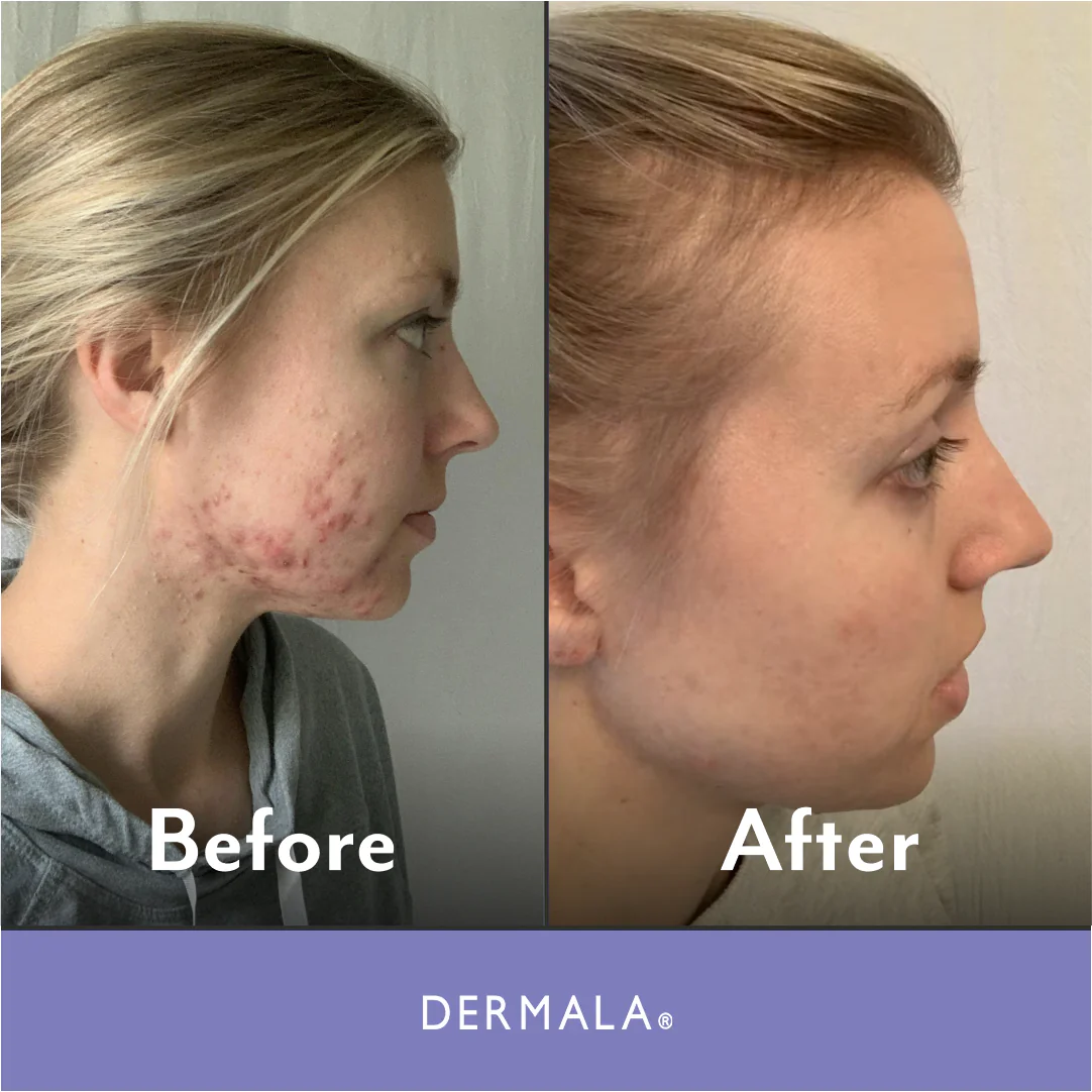 SUPPLEMEANT to Be® Pre+Probiotic+Vitamin Skin Mix - Image 3