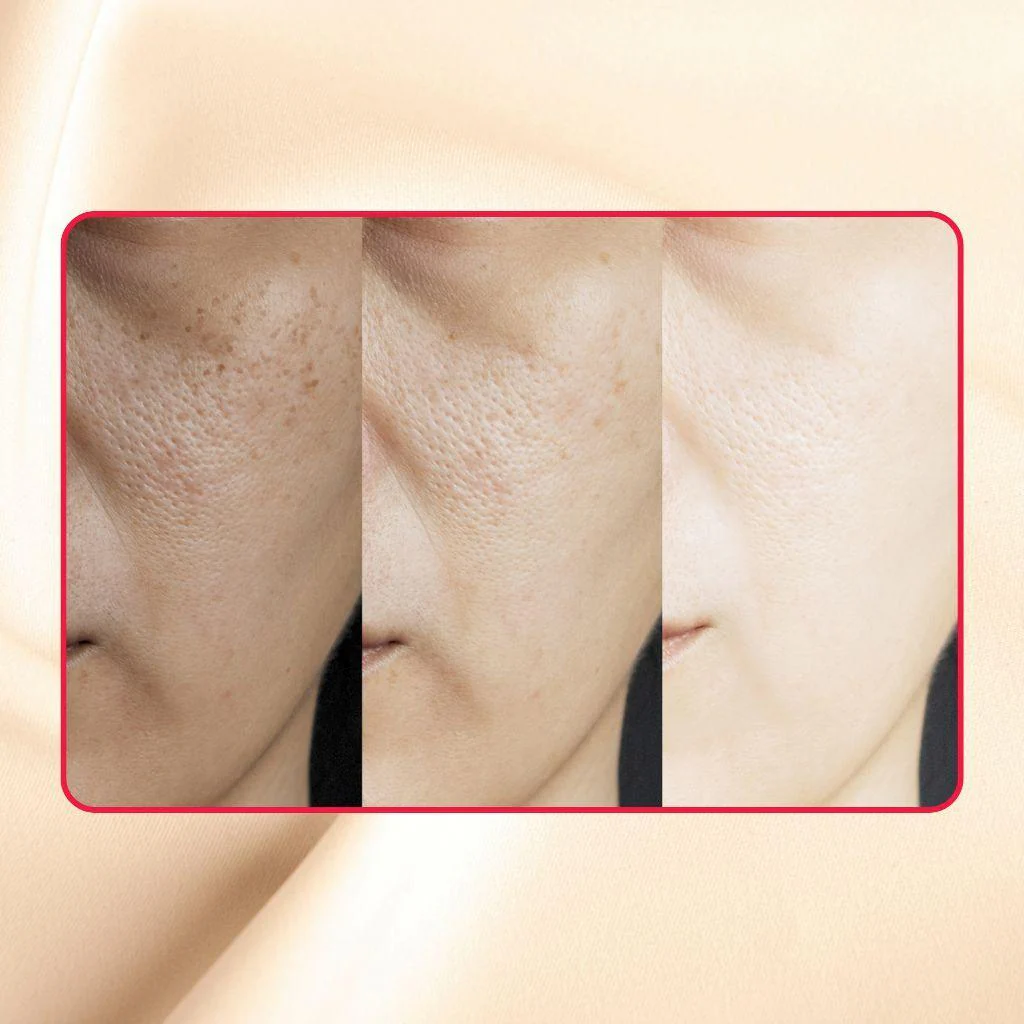 Thick As Thieves Pure Glycolic Acid Lactic Acid Extreme Gel Peel - 30ml - Image 4