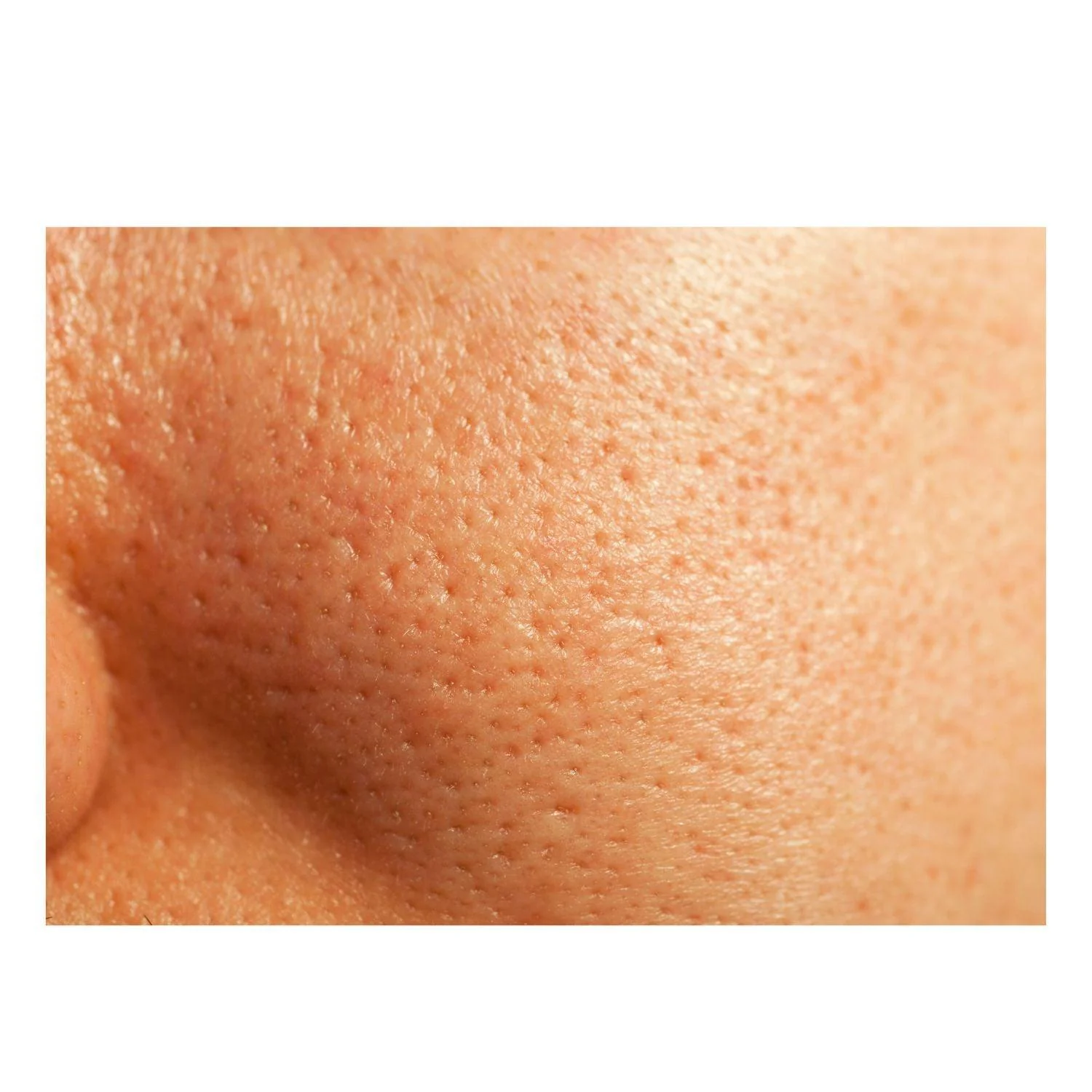 Thick As Thieves Pure Glycolic Acid Lactic Acid Extreme Gel Peel - 30ml - Image 7