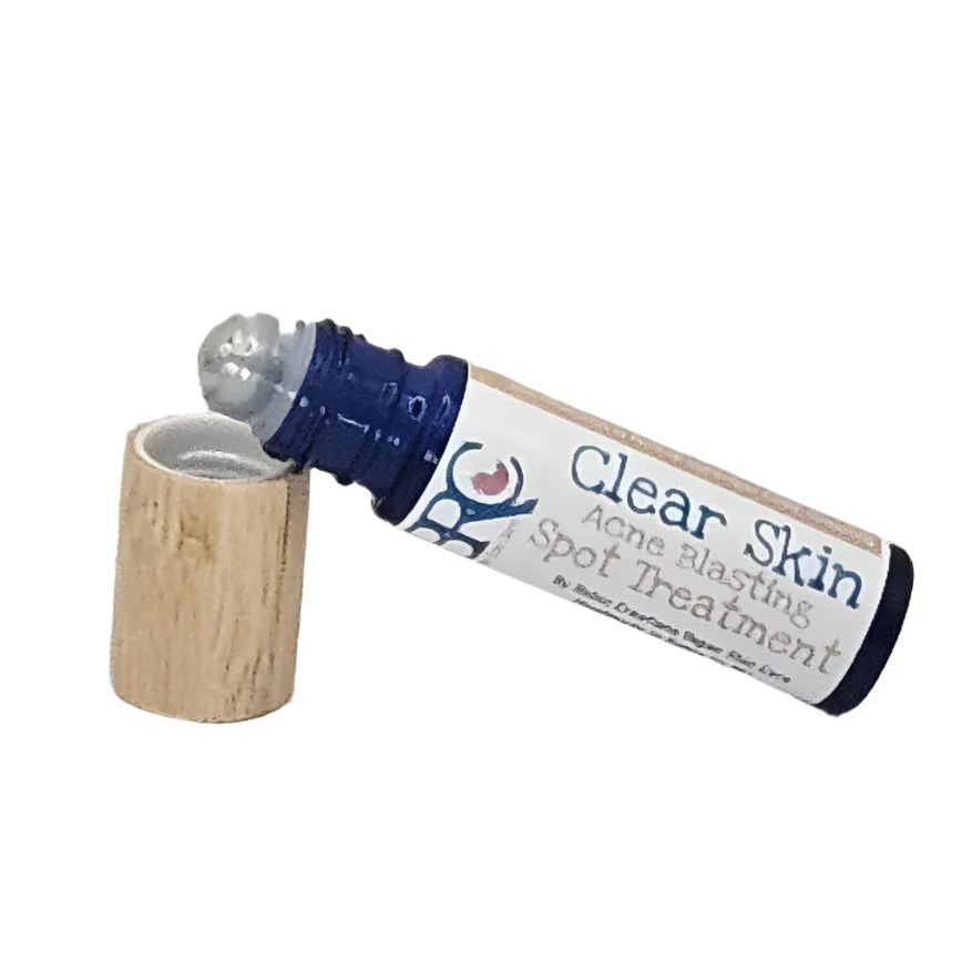 Ultimate Clear Skin Acne Healing Facial Bundle w/Free Healing Cleansing Bar - Image 3