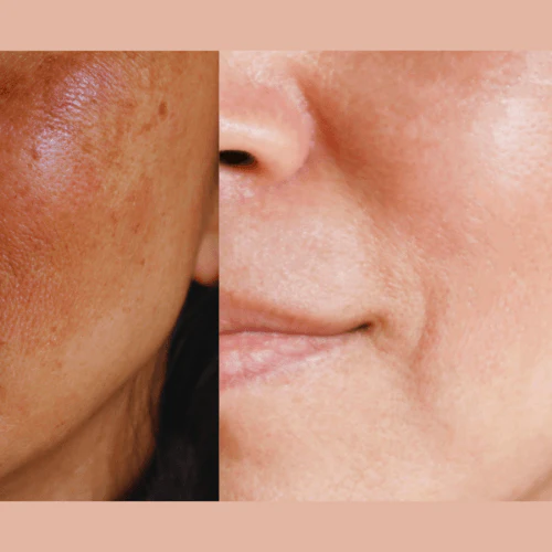 Ultra-Advanced Anti-Aging Daily Resurfacing Pads - Image 4