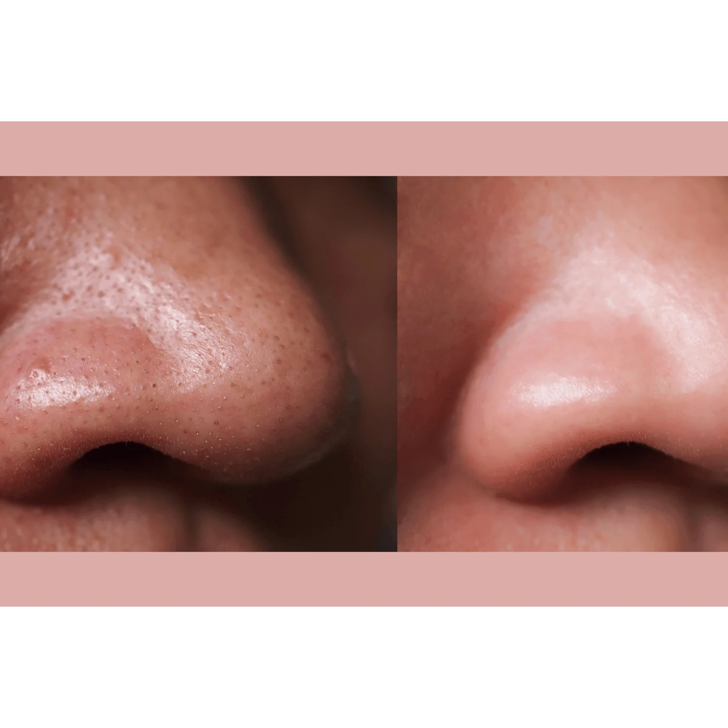Ultra-Advanced Anti-Aging Daily Resurfacing Pads - Image 5