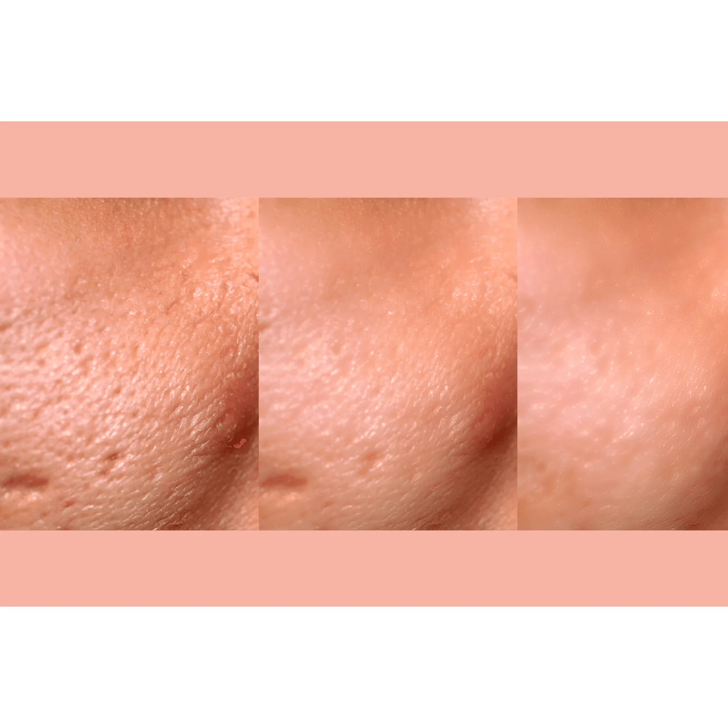Ultra-Advanced Anti-Aging Daily Resurfacing Pads - Image 6