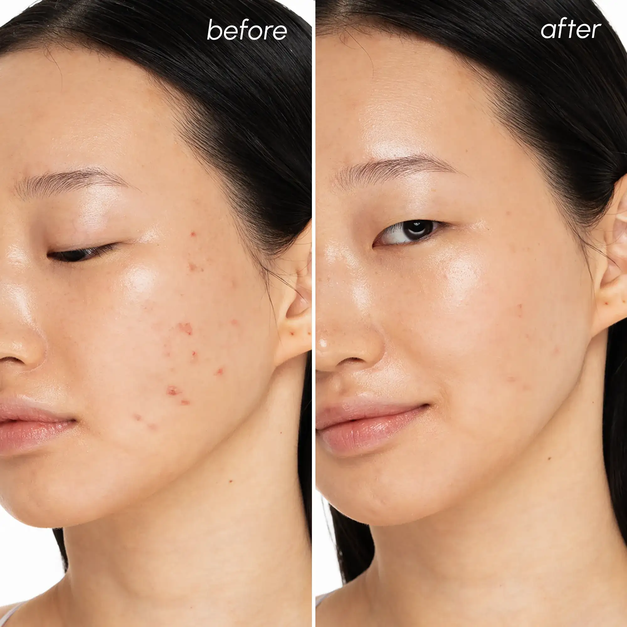 Witch Hazel Clearing Pads - Image 3